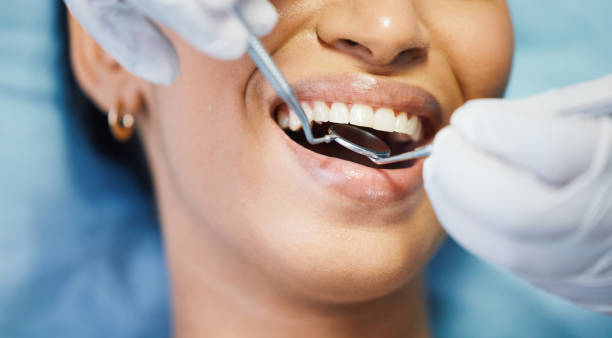 Best Emergency Root Canal Treatment in Decatur, IL
